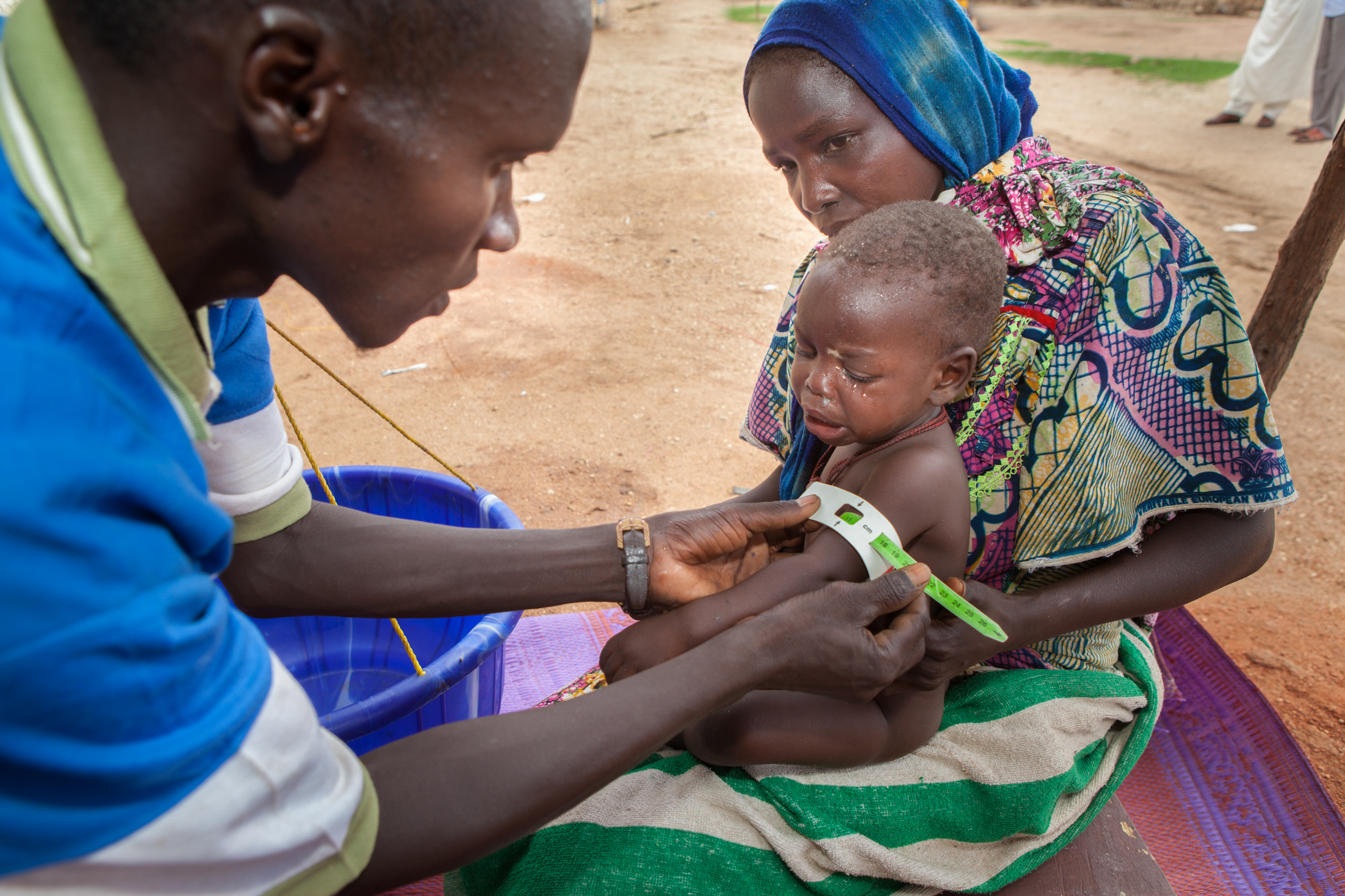malnutrition-perimetre-brachiale-tchad